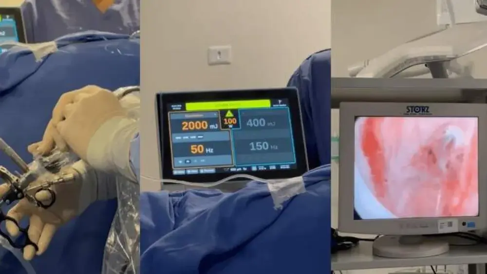 HU realiza 5 cirurgias inéditas de próstata a laser no SUS